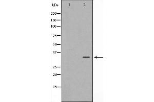 Western blot analysis on HuvEc cell lysate using C/EBP-epsilon Antibody. (CEBPE 抗体  (Internal Region))