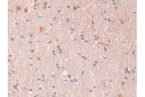 Immunohistochemistry (IHC) image for anti-serpin Peptidase Inhibitor, Clade A (Alpha-1 Antiproteinase, Antitrypsin), Member 1 (SERPINA1) (AA 25-418) antibody (ABIN7429052)