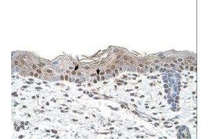 Image no. 1 for anti-Arrestin, beta 2 (ARRB2) (AA 151-200) antibody (ABIN6738415) (Arrestin 3 抗体  (AA 151-200))