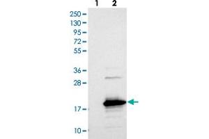 Western blot analysis of Lane 1: Negative control (vector only transfected HEK293T lysate), Lane 2: Over-expression Lysate (Co-expressed with a C-terminal myc-DDK tag (~3. (SAMD12 抗体)