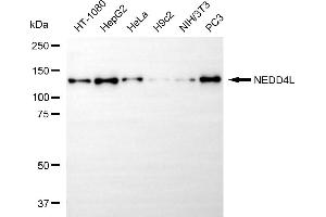 Western blotting analysis using NEDD4L antibody (ABIN7798419).