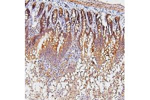 IHC analysis of TDRD3 using anti-TDRD3 antibody (ABIN6719636). (TDRD3 抗体)