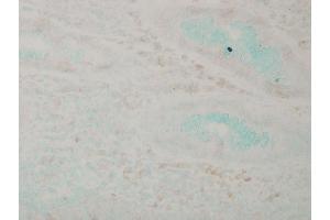 Immunohistochemistry (IHC) image for anti-Mitogen-Activated Protein Kinase 14 (MAPK14) antibody (PerCP) (ABIN2486145)
