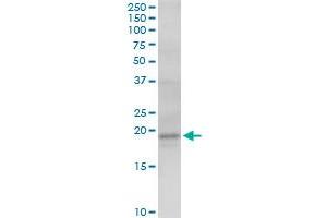 AGTRAP MaxPab polyclonal antibody. (AGTRAP 抗体  (AA 1-152))