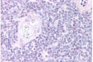 Human Thymus, Medulla (formalin-fixed, paraffin-embedded) stained with FOXN1 antibody ABIN297057 at 20 ug/ml followed by biotinylated anti-goat IgG secondary antibody ABIN481715, alkaline phosphatase-streptavidin and chromogen. (FOXN1 抗体  (AA 635-648))