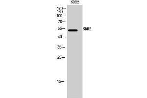 Western Blotting (WB) image for anti-serine/threonine Kinase 38 Like (STK38L) (C-Term) antibody (ABIN3185788)