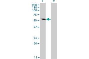 Western Blotting (WB) image for anti-GTPase Activating Protein (SH3 Domain) Binding Protein 1 (G3BP1) (AA 214-303) antibody (ABIN564390)