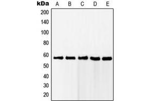 Western blot analysis of RAB11FIP2 expression in Jurkat (A), HeLa (B), MCF7 (C), A431 (D), HEK293 (E) whole cell lysates. (RAB11FIP2 抗体  (Center))