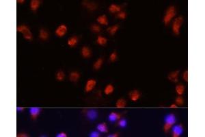 Immunofluorescence analysis of A431 cells using ACVR2A Polyclonal Antibody at dilution of 1:100 (40x lens). (ACVR2A 抗体)