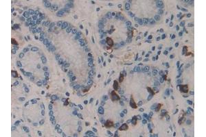 DAB staining on IHC-P; Samples: Human Stomach Tissue (HSF4 抗体  (AA 171-284))