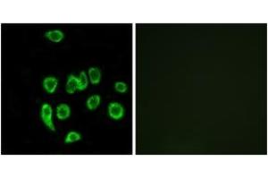 Immunofluorescence analysis of A549 cells, using MRPL32 Antibody. (MRPL32 抗体  (AA 101-150))