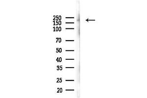 Western blot analysis of lysates from COLO205 cells(heat-shock,45 min treatment), using DCC Antibody at 1/1000 dilution.