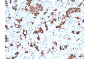 Formalin-fixed, paraffin-embedded human Pituitary stained with Prolactin Mouse Monoclonal Antibody (PRL/2644). (Prolactin 抗体  (AA 63-201))