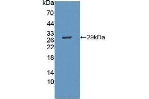 Detection of Recombinant CRISP1, Mouse using Polyclonal Antibody to Cysteine Rich Secretory Protein 1 (CRISP1) (CRISP1 抗体  (AA 20-244))