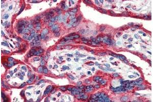 Human Placenta (formalin-fixed, paraffin-embedded) stained with HSP90B1 antibody ABIN462106 at 10 ug/ml followed by biotinylated secondary antibody, alkaline phosphatase-streptavidin and chromogen. (GRP94 抗体)
