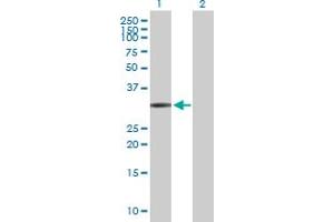 Western Blot analysis of FCN1 expression in transfected 293T cell line by FCN1 MaxPab polyclonal antibody. (FCN1 抗体  (AA 1-326))