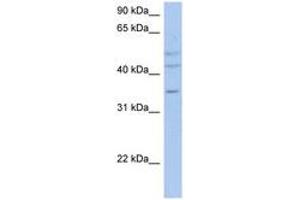 Image no. 1 for anti-PXYLP1 / ACPL2 (AA 71-120) antibody (ABIN6743334) (PXYLP1 / ACPL2 (AA 71-120) 抗体)