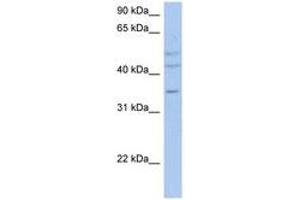 anti-PXYLP1 / ACPL2 (AA 71-120) antibody
