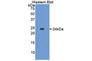Western Blotting (WB) image for anti-Amyloid P Component, Serum (APCS) (AA 20-223) antibody (ABIN1174754) (APCS 抗体  (AA 20-223))