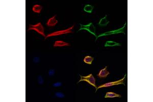 ABIN6264064 and ABIN6277250 staining Hela cells by IF/ICC. (PCBP2 抗体  (Internal Region))