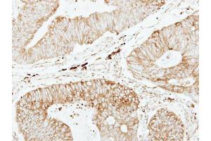 Immunohistochemistry (IHC) image for anti-Glutathione S-Transferase pi 1 (GSTP1) (N-Term) antibody (ABIN2854701)