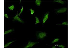 Immunofluorescence of monoclonal antibody to MAPK3 on HeLa cell. (ERK1 抗体  (AA 279-379))