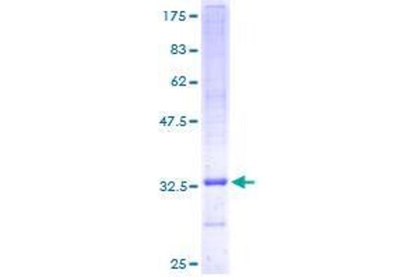 UQCR10 Protein (AA 1-63) (GST tag)