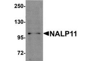 Western blot analysis of NALP11 in HeLa cell lysate with NALP11 antibody at 1 μg/ml. (NLRP11 抗体  (C-Term))