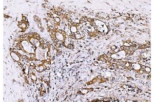 IHC analysis of GPR54/KISS1R using anti-GPR54/KISS1R antibody (ABIN7602153).