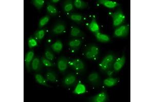 Immunofluorescence analysis of MCF7 cells using DR1 antibody (ABIN6130316, ABIN6139817, ABIN6139819 and ABIN6217241). (DR1 抗体  (AA 1-176))