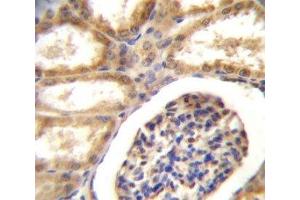 DDR1 antibody immunohistochemistry analysis in formalin fixed and paraffin embedded human kidney tissue. (DDR1 抗体  (AA 17-47))