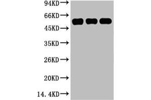 Western blot analysis of 1) Hela, 2) Mouse Kidney tissue, 3) Rat Heart tissue, diluted at 1:5000. (TUBB3 抗体)