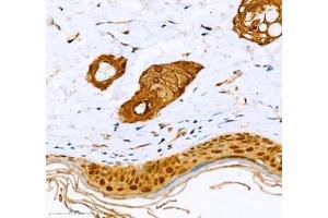 Immunohistochemistry (Paraffin-embedded Sections) (IHC (p)) image for anti-Annexin A8 (ANXA8) antibody (ABIN7073071)