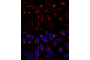 Immunofluorescence (IF) image for anti-Vimentin (VIM) (AA 1-200) antibody (ABIN3016292)