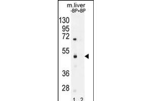 Western blot analysis of SD8 Antibody (N-term) Pab (ABIN655974 and ABIN2845359) pre-incubated without(lane 1) and with(lane 2) blocking peptide in mouse liver tissue lysate. (SAMD8 抗体  (N-Term))