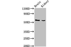 Western Blot Positive WB detected in: Mouse brain tissue, Mouse kidney tissue All lanes: SLC25A23 antibody at 3 μg/mL Secondary Goat polyclonal to rabbit IgG at 1/50000 dilution Predicted band size: 53, 50, 55, 49 kDa Observed band size: 53 kDa
