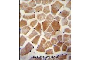 WISP2 Antibody (Center) A immunohistochemistry analysis in formalin fixed and paraffin embedded human skeletal muscle followed by peroxidase conjugation of the secondary antibody and DAB staining. (WISP2 抗体  (AA 87-116))