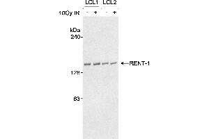 Western Blotting (WB) image for anti-UPF1 Regulator of Nonsense Transcripts Homolog (UPF1) (AA 250-300) antibody (ABIN7449176) (RENT1/UPF1 抗体  (AA 250-300))