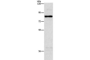 Western Blot analysis of Hela cell using NOL9 Polyclonal Antibody at dilution of 1:1250
