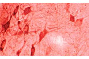 Immunohistochemistry analysis using Rabbit Anti-HO-1 Polyclonal Antibody . (HMOX1 抗体)