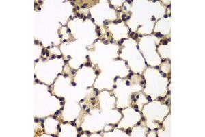 Immunohistochemistry of paraffin-embedded mouse lung using E2F6 antibody (ABIN5973627) at dilution of 1/200 (40x lens). (E2F6 抗体)