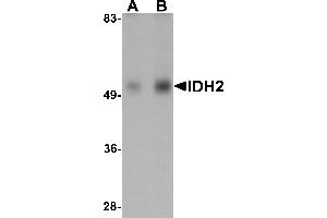 Western Blotting (WB) image for anti-Isocitrate Dehydrogenase 2 (NADP+), Mitochondrial (IDH2) (N-Term) antibody (ABIN1031407) (IDH2 抗体  (N-Term))