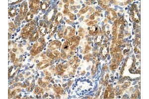 Immunohistochemistry (IHC) image for anti-MAS1 Oncogene (MAS1) (Middle Region) antibody (ABIN2784456) (MAS1 抗体  (Middle Region))