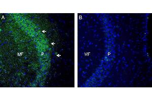 Expression of TSH Receptor in mouse hippocampus. (TSH receptor 抗体  (Extracellular, N-Term))