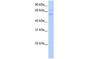 WB Suggested Anti-CPN2 Antibody Titration: 0. (CPN2 抗体  (N-Term))