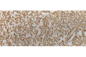 Immunohistochemistry of paraffin-embedded Human tonsil tissue using ZNF8 Polyclonal Antibody at dilution of 1:40(x200) (ZNF8 抗体)