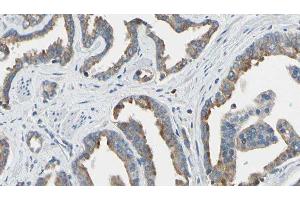 ABIN6277658 at 1/100 staining Human prostate tissue by IHC-P. (TK1 抗体  (N-Term))