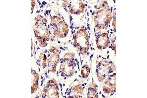 Immunohistochemical analysis of raffin-embedded H.