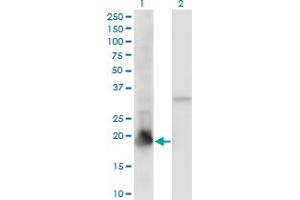 Western Blot analysis of PPIL1 expression in transfected 293T cell line by PPIL1 monoclonal antibody (M01), clone 2C2. (PPIL1 抗体  (AA 76-166))