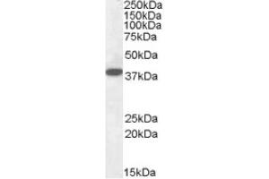 Image no. 1 for anti-Epilepsy, Progressive Myoclonus Type 2A, Lafora Disease (Laforin) (EPM2A) (Internal Region), (Isoform A) antibody (ABIN375087) (EPM2A 抗体  (Internal Region, Isoform A))